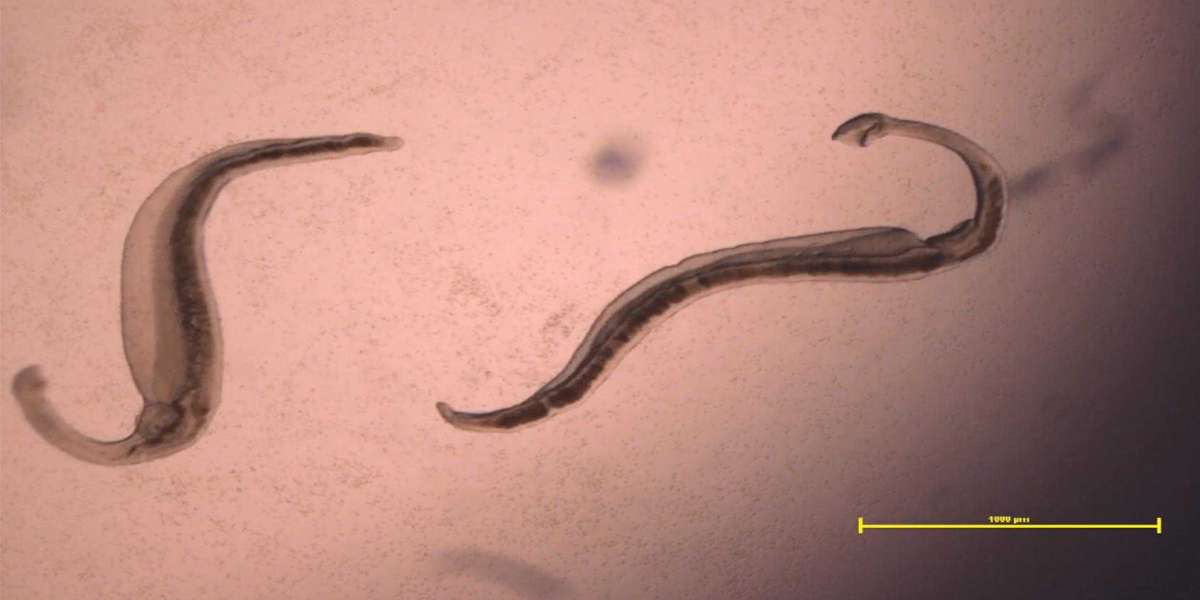 Understanding Schistosomiasis: Causes, Symptoms, and Treatment Options