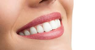 Bright Smiles Await: Teeth Whitening Offers in Sharjah | TechPlanet