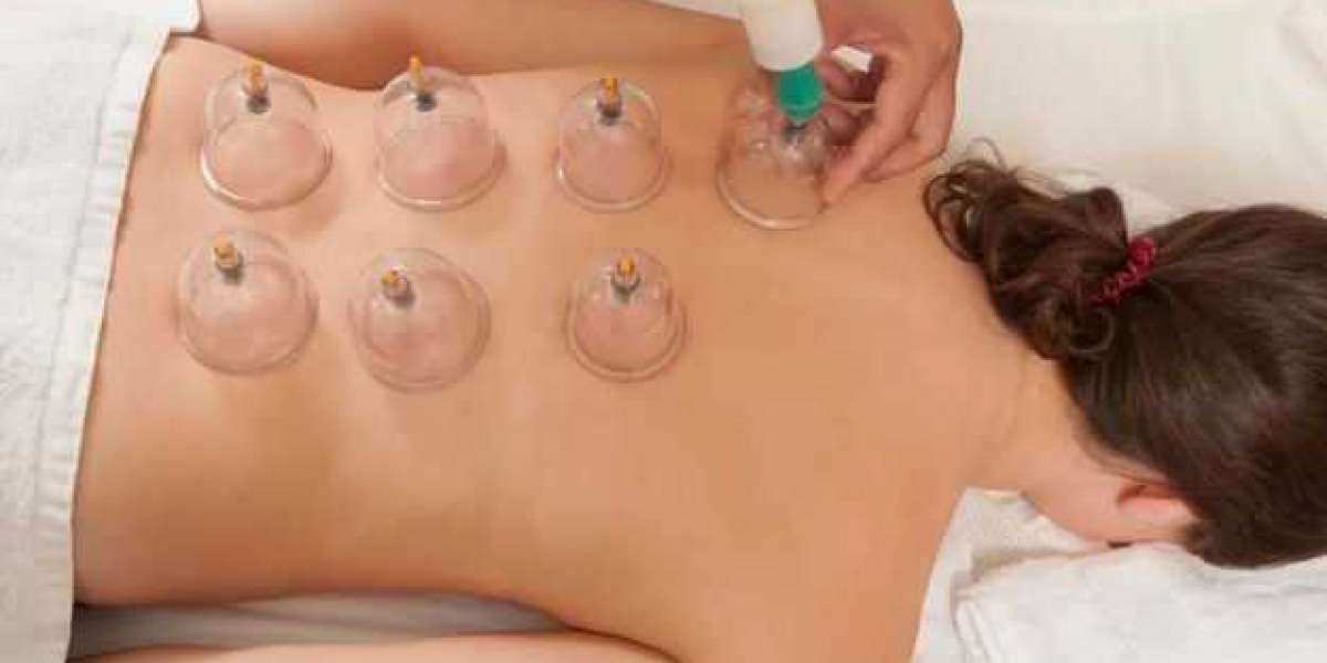 Hijama- Cupping Therapy Plano