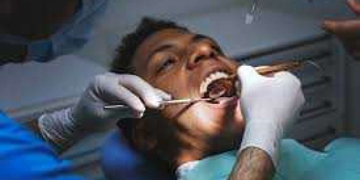 Why Tooth Extraction Is Necessary: Common Causes Uncovered