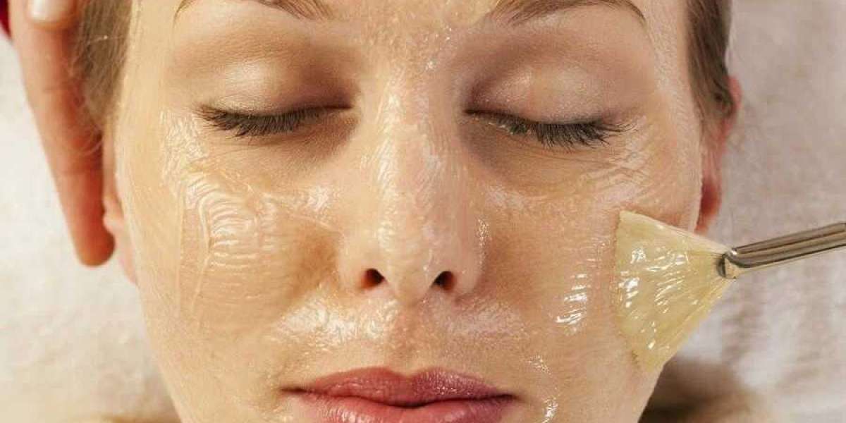 Achieve Glowing Skin with Chemical Peel Treatment in Pakistan