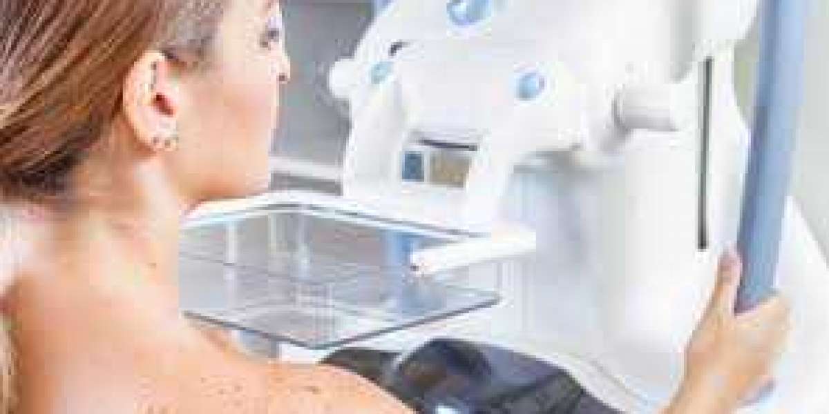 What Is Mammography and How Does It Detect Breast Cancer?