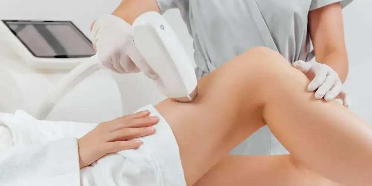 Hair Removal Frisco TX at Sleek Laser Solution