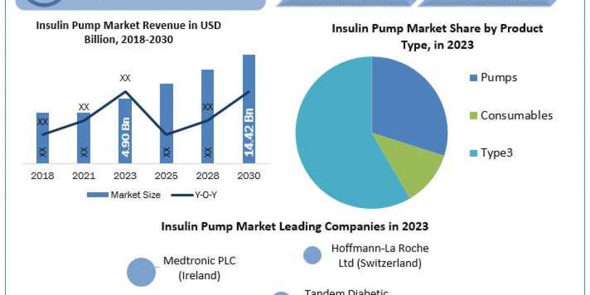 Insulin Pump Market  Research, Developments, Expansion, Statistics, Alternatives & Forecast To 2030