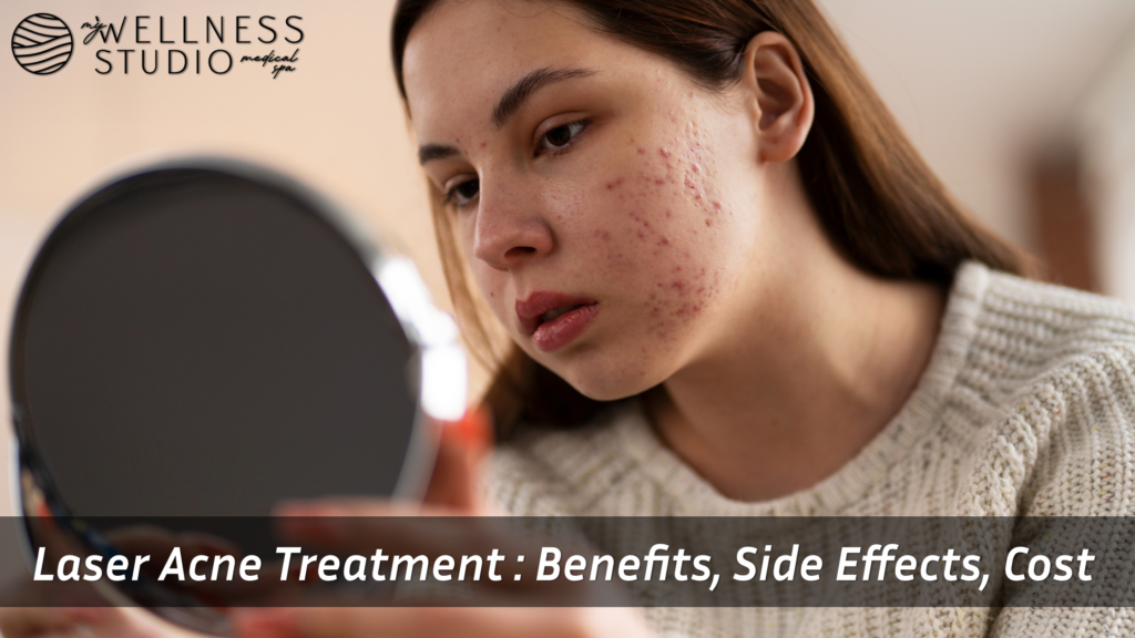 Laser Acne Treatment: Benefits, Side Effects, and Cost