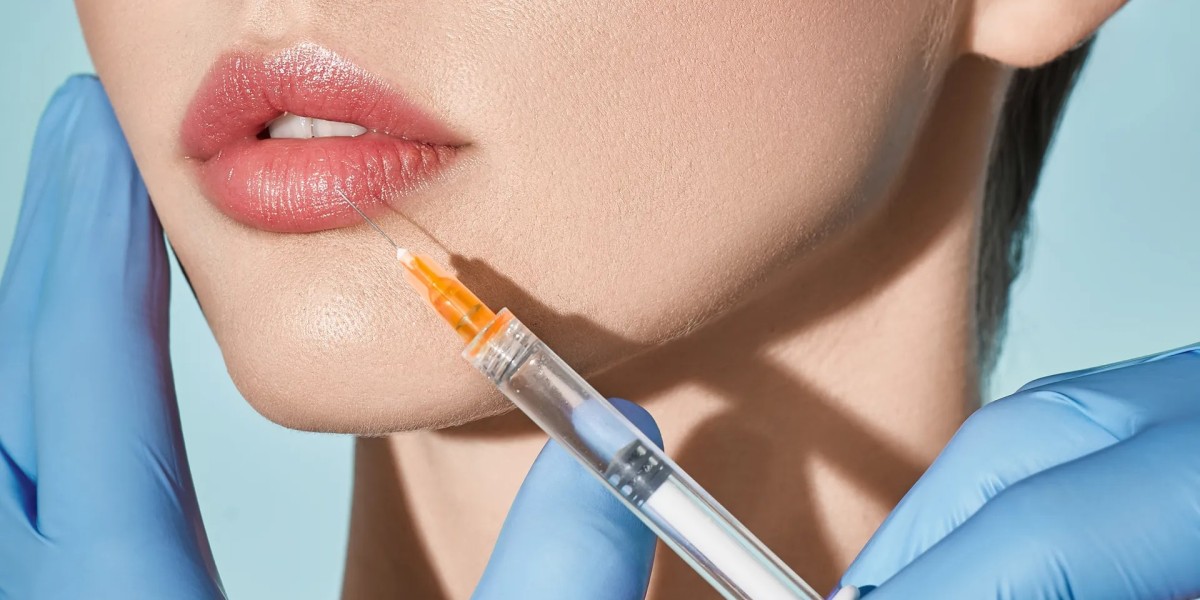 Everything You Need to Know About Lip Injections in West Palm Beach