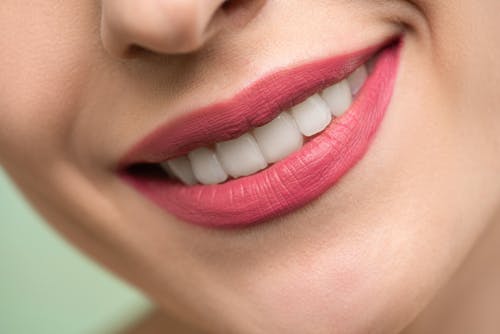 Teeth Whitening Treatment in Ahmedabad | PR Smile