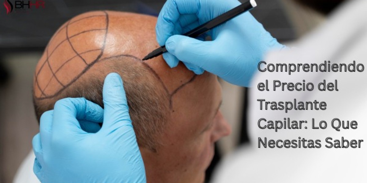 Comprendiendo el Precio del Trasplante Capilar: Lo Que Necesitas Saber