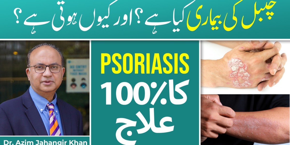 Article Picture